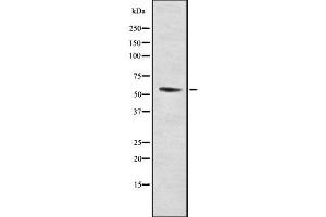 Image no. 3 for anti-URI1, Prefoldin-Like Chaperone (URI1) antibody (ABIN6264773)