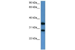 Image no. 1 for anti-serine/threonine/tyrosine Interacting-Like 1 (STYXL1) (Middle Region) antibody (ABIN2788428)