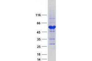 Image no. 1 for SAP30 Binding Protein (SAP30BP) protein (Myc-DYKDDDDK Tag) (ABIN2731393)
