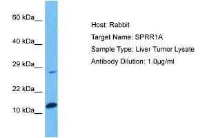 Image no. 1 for anti-Small Proline Rich Protein 1A (SPRR1A) (Middle Region) antibody (ABIN2789534)