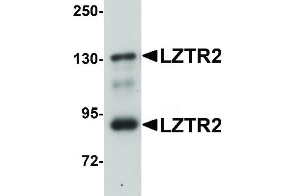 anti-SEC16 Homolog B (SEC16B) (C-Term) antibody