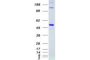 Image no. 1 for serine/threonine Kinase 38 (STK38) protein (Myc-DYKDDDDK Tag) (ABIN2732876)