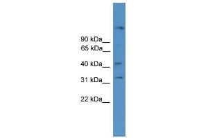 Image no. 1 for anti-Synaptotagmin XI (SYT11) (N-Term) antibody (ABIN2788082)