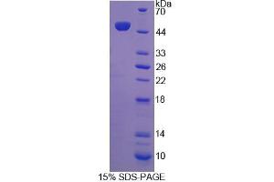 Image no. 1 for Reticulon 1 (RTN1) (AA 593-780) protein (His tag,GST tag) (ABIN6239380)