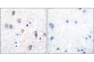 Image no. 3 for anti-Amyloid beta (Abeta) (AA 711-760) antibody (ABIN2888562)