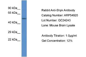 Image no. 1 for anti-Sedoheptulokinase (SHPK) (Middle Region) antibody (ABIN2785956)