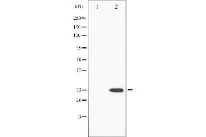 Image no. 4 for anti-Eukaryotic Translation Initiation Factor 4E (EIF4E) (pSer209) antibody (ABIN6255087)