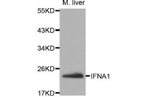 Image no. 2 for anti-Interferon alpha (IFNA) antibody (ABIN3020881)