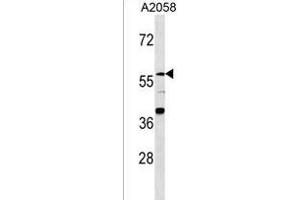 ZNF776 抗体  (N-Term)