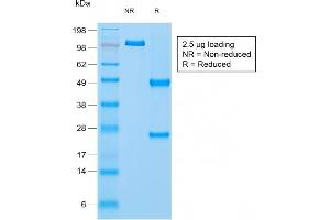 Image no. 1 for anti-Napsin A Aspartic Peptidase (NAPSA) (AA 189-299) antibody (ABIN6941166)