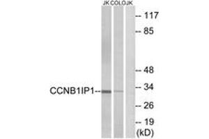Image no. 1 for anti-Cyclin B1 Interacting Protein 1 (CCNB1IP1) (AA 201-250) antibody (ABIN1534858)