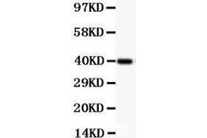 Image no. 3 for anti-Nuclear Factor of kappa Light Polypeptide Gene Enhancer in B-Cells 1 (NFKB1) (AA 1-360) antibody (ABIN3043587)