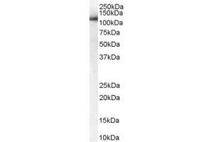 Image no. 2 for anti-USO1 Homolog, Vesicle Docking Protein (USO1) (C-Term) antibody (ABIN185504)
