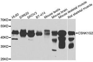 Image no. 1 for anti-Casein Kinase 1, gamma 2 (CSNK1G2) antibody (ABIN6139122)