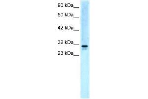 Image no. 1 for anti-Vacuolar-sorting Protein SNF8 (SNF8) (N-Term) antibody (ABIN927326)