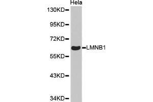 Western Blotting (WB) image for anti-Lamin B1 (LMNB1) antibody (ABIN1513160)