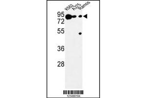 Western Blotting (WB) image for anti-Dopachrome Tautomerase (DCT) antibody (ABIN2158498)