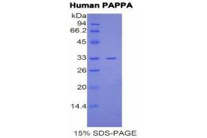 Image no. 1 for Pregnancy-Associated Plasma Protein A, Pappalysin 1 (PAPPA) (AA 244-501) protein (His tag) (ABIN1877279)