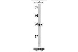 Western Blotting (WB) image for anti-Ethylmalonic Encephalopathy 1 (ETHE1) antibody (ABIN2158749)