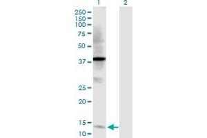 Image no. 1 for anti-Trefoil Factor 2 (TFF2) (AA 1-129) antibody (ABIN520856)