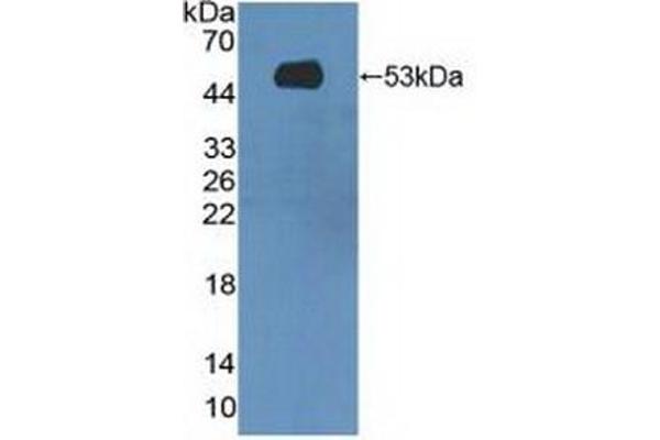 MASP1 antibody  (AA 20-447)