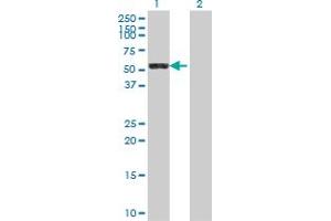 Image no. 2 for anti-Cytosol Aminopeptidase (LAP3) (AA 420-519) antibody (ABIN565519)