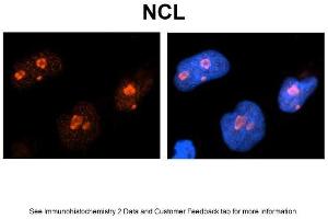 Image no. 3 for anti-Nucleolin (NCL) (C-Term) antibody (ABIN2778936)