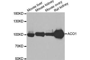Image no. 2 for anti-Aconitase 1 (ACO1) antibody (ABIN1877037)