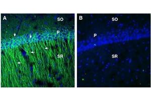 Expression of EphA2 in rat hippocampus.