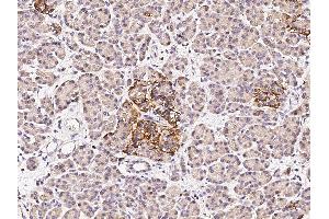 Image no. 2 for anti-Fanconi Anemia, Complementation Group C (FANCC) (N-Term) antibody (ABIN6924697)