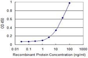 anti-Potassium Large Conductance Calcium-Activated Channel, Subfamily M beta Member 3 (KCNMB3) (AA 82-181) antibody