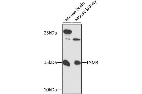 LSM3 抗体  (AA 1-102)