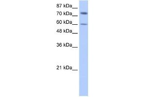 Image no. 1 for anti-Insulin-Like Growth Factor 2 mRNA Binding Protein 1 (IGF2BP1) (N-Term) antibody (ABIN633481)