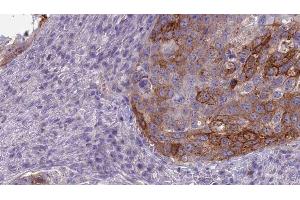 Image no. 2 for anti-Guanine Nucleotide Binding Protein, alpha Stimulating, Olfactory Type (GNAL) (Internal Region) antibody (ABIN6259085)