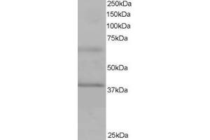 Image no. 2 for anti-Ankyrin Repeat and BTB (POZ) Domain Containing 1 (ABTB1) (C-Term) antibody (ABIN184640)