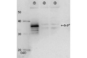 Image no. 1 for anti-Prion Protein (PRNP) antibody (ABIN2452080)