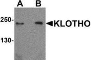 Image no. 3 for anti-Klotho (KL) (Center) antibody (ABIN783343)