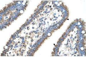 Image no. 3 for anti-Carbamoyl-Phosphate Synthase 1, Mitochondrial (CPS1) (N-Term) antibody (ABIN2782318)