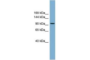 WB Suggested Anti-PPP1R3A Antibody Titration:  0.