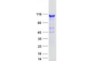 Image no. 1 for HNF1 Homeobox A (HNF1A) protein (Myc-DYKDDDDK Tag) (ABIN2722892)