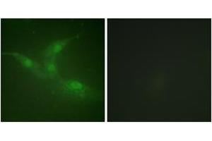 Immunofluorescence analysis of NIH-3T3 cells, using Breast Tumor Kinase (Phospho-Tyr447) Antibody.