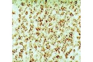 Formalin fixed paraffin embedded human lymph node stained with Hairy Cell Leukemia antibody ABIN114690