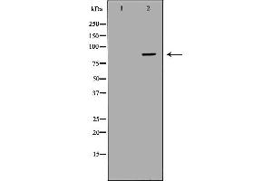 Image no. 3 for anti-Complement Factor B (CFB) (Internal Region) antibody (ABIN6260775)