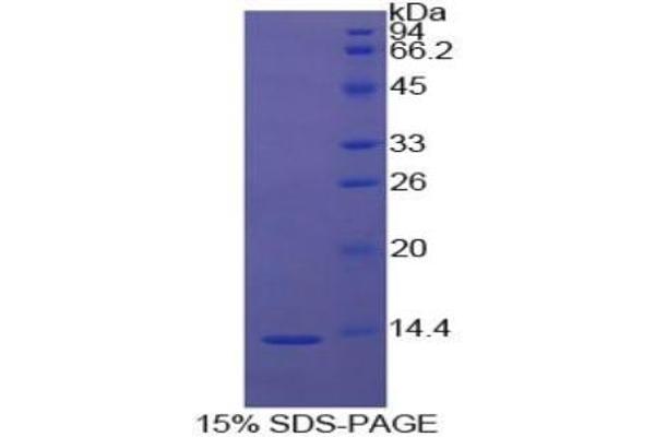 PIGR ELISA Kit