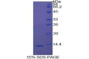 Image no. 5 for Polymeric Immunoglobulin Receptor (PIGR) ELISA Kit (ABIN6720493)