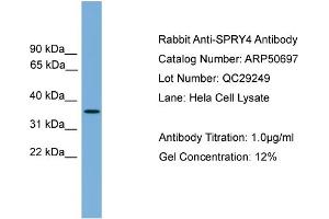 Image no. 2 for anti-Sprouty RTK Signaling Antagonist 4 (SPRY4) (Middle Region) antibody (ABIN2784290)