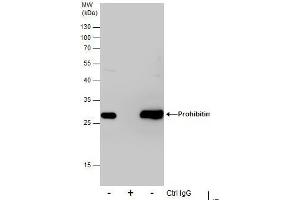 IP Image Immunoprecipitation of Prohibitin protein from 293T whole cell extracts using 5 μg of Prohibitin antibody, Western blot analysis was performed using Prohibitin antibody, EasyBlot anti-Rabbit IgG  was used as a secondary reagent.