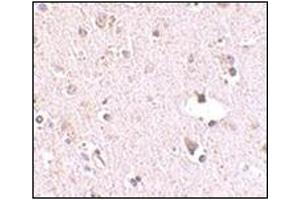 Image no. 1 for anti-Polymerase (RNA) III (DNA Directed) Polypeptide F, 39 KDa (POLR3F) (N-Term) antibody (ABIN500523)
