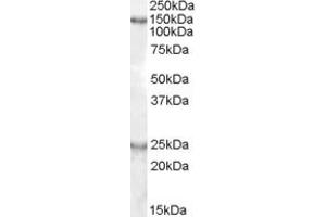 Image no. 1 for anti-KIAA0319 (KIAA0319) (Internal Region) antibody (ABIN263153)