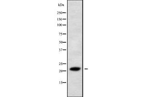Image no. 1 for anti-Interleukin 28A (Interferon, lambda 2) (IL28A) (N-Term) antibody (ABIN6262560)